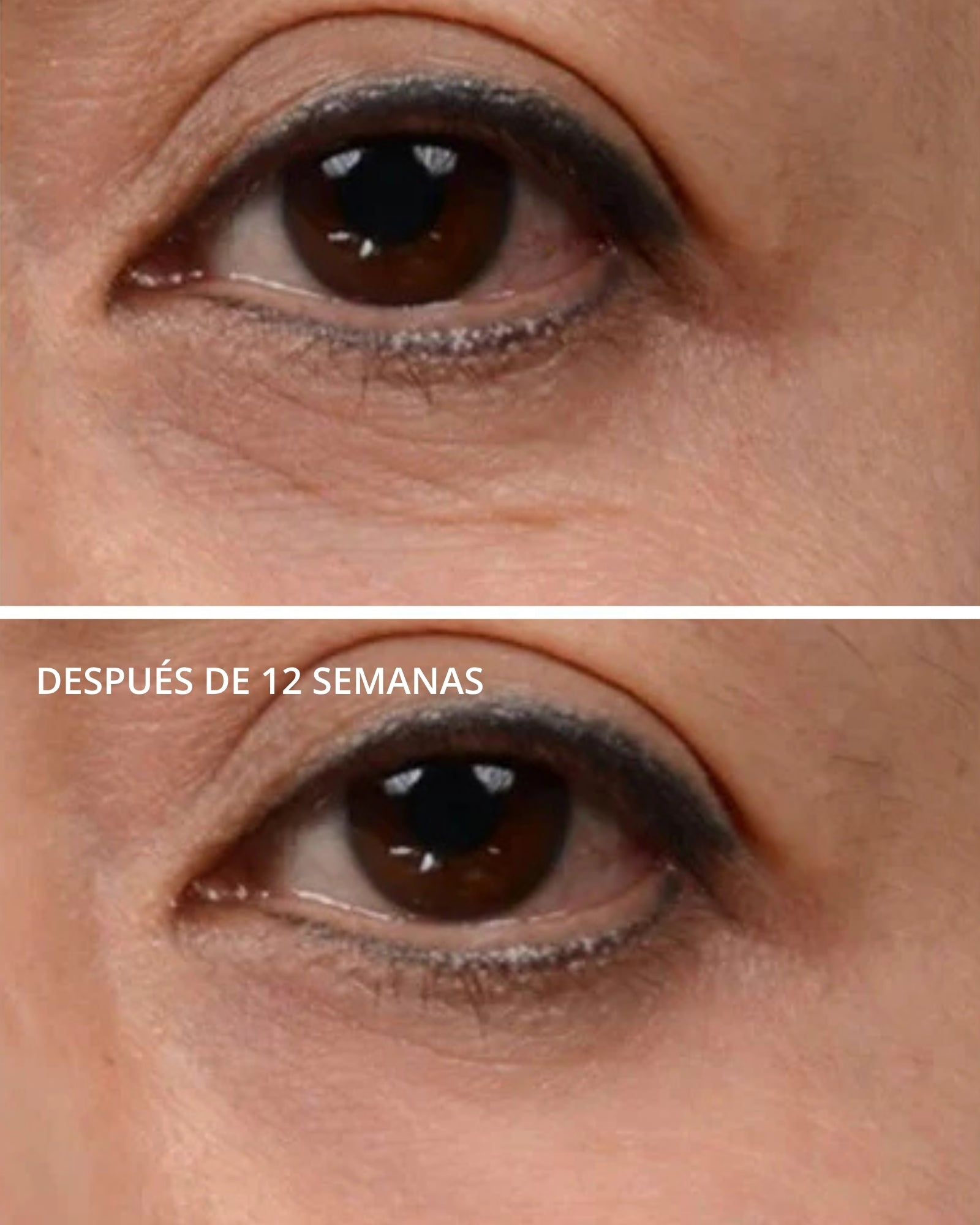 Brightening Eye Cream Neostrata