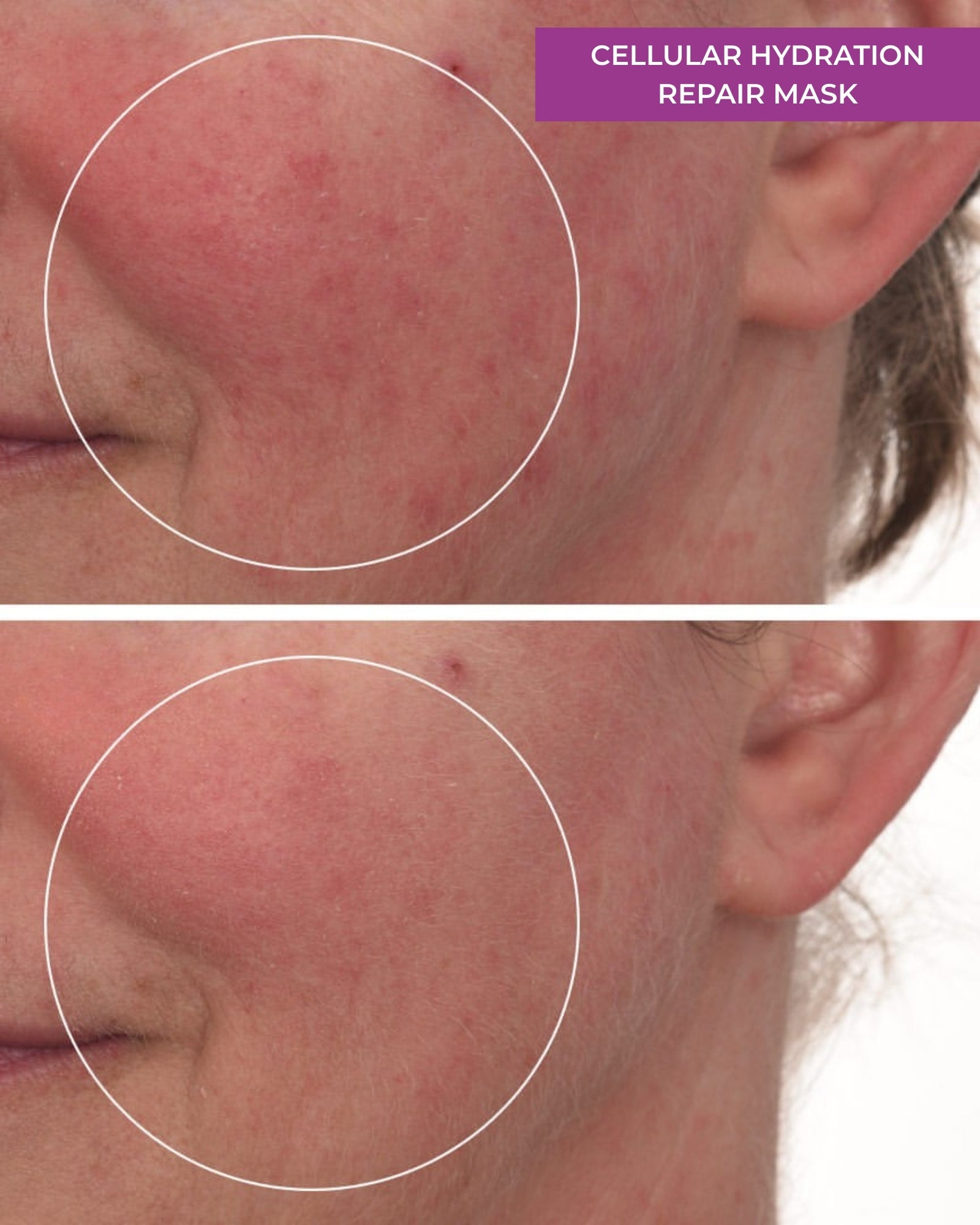 Cellular Hydration Repair Mask