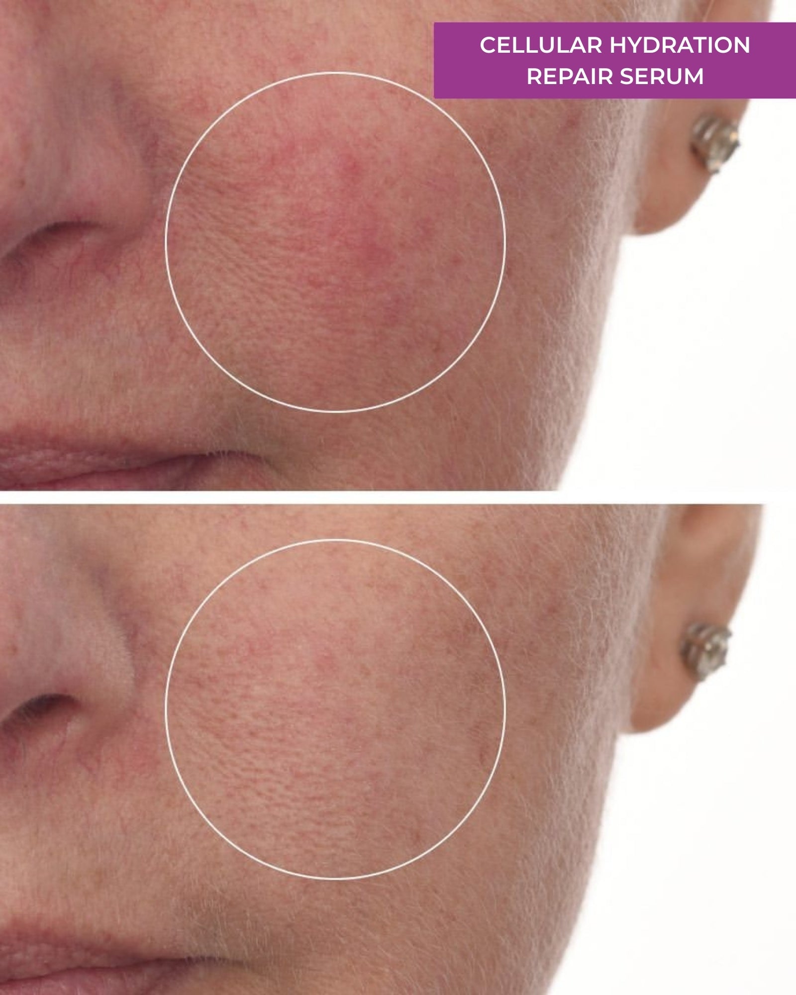Cellular Hydration Repair Serum