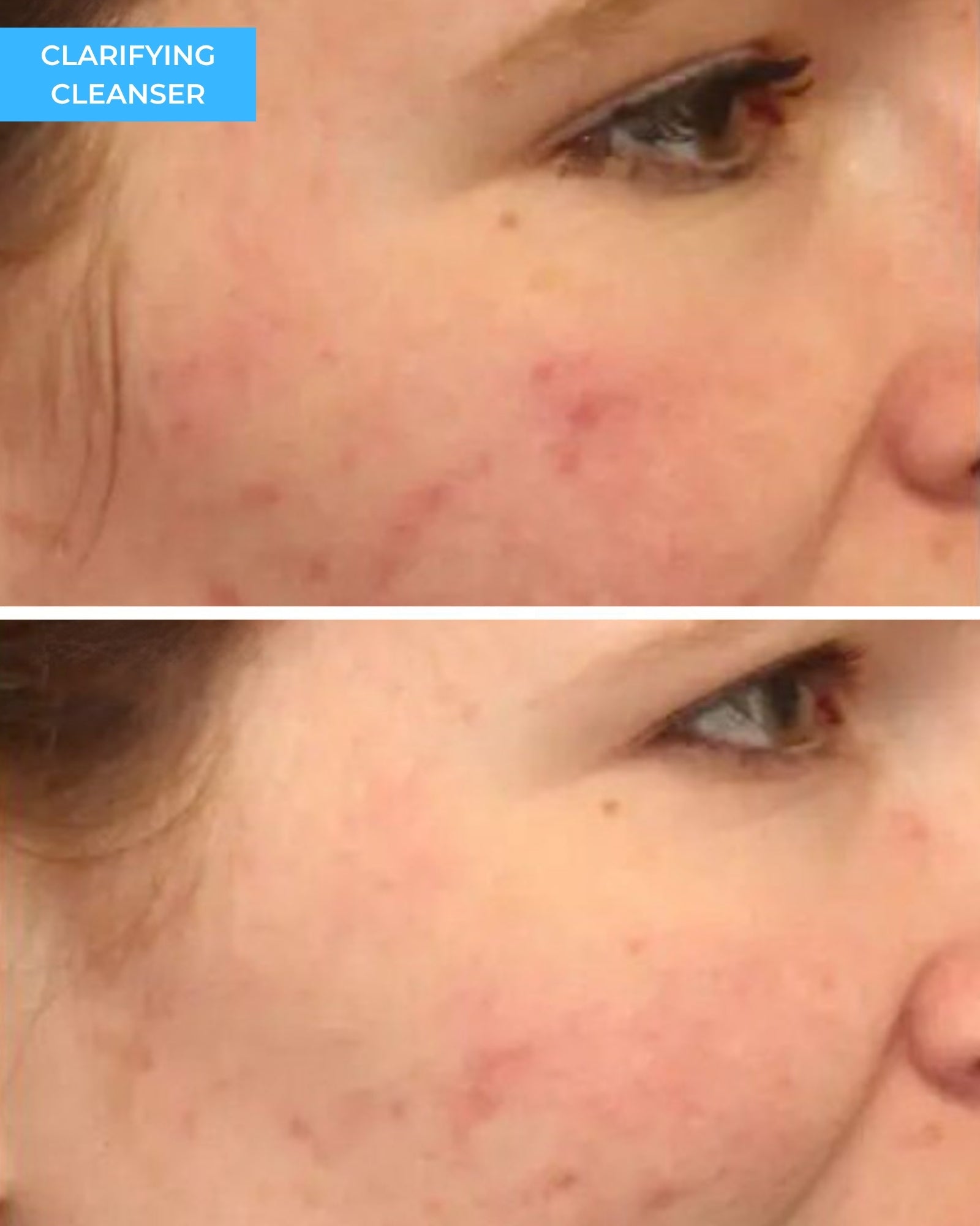 Clarifying Cleanser