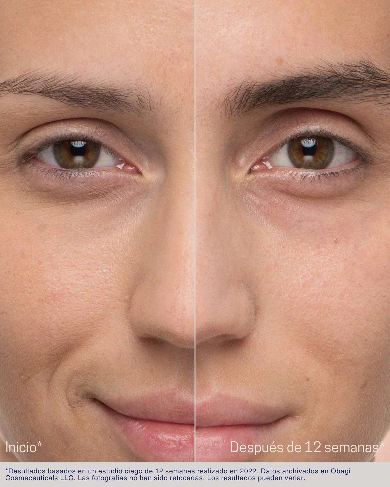 Nu-Cil® Eyebrow Boosting Serum Obagi