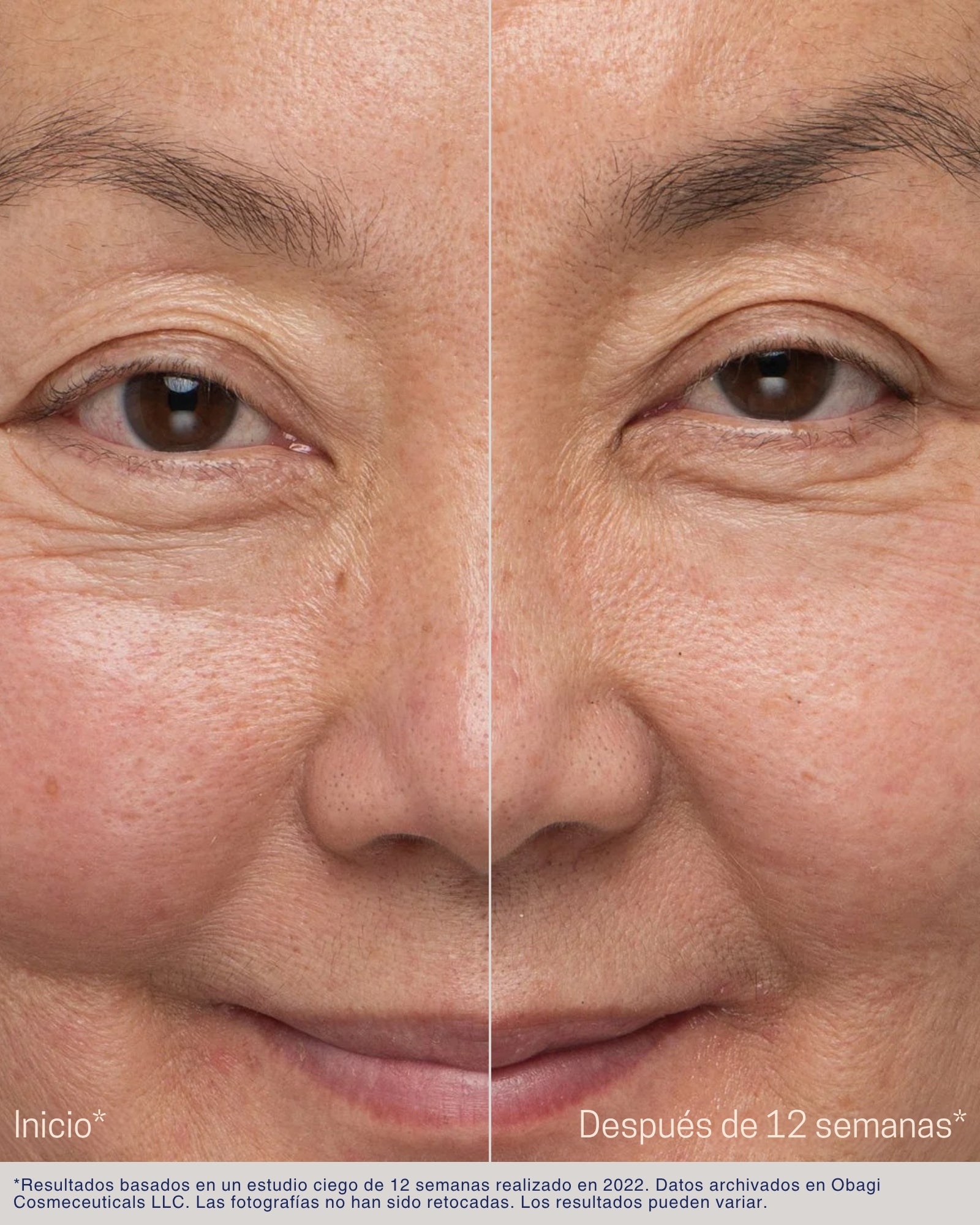 Nu-Cil® Eyebrow Boosting Serum Obagi