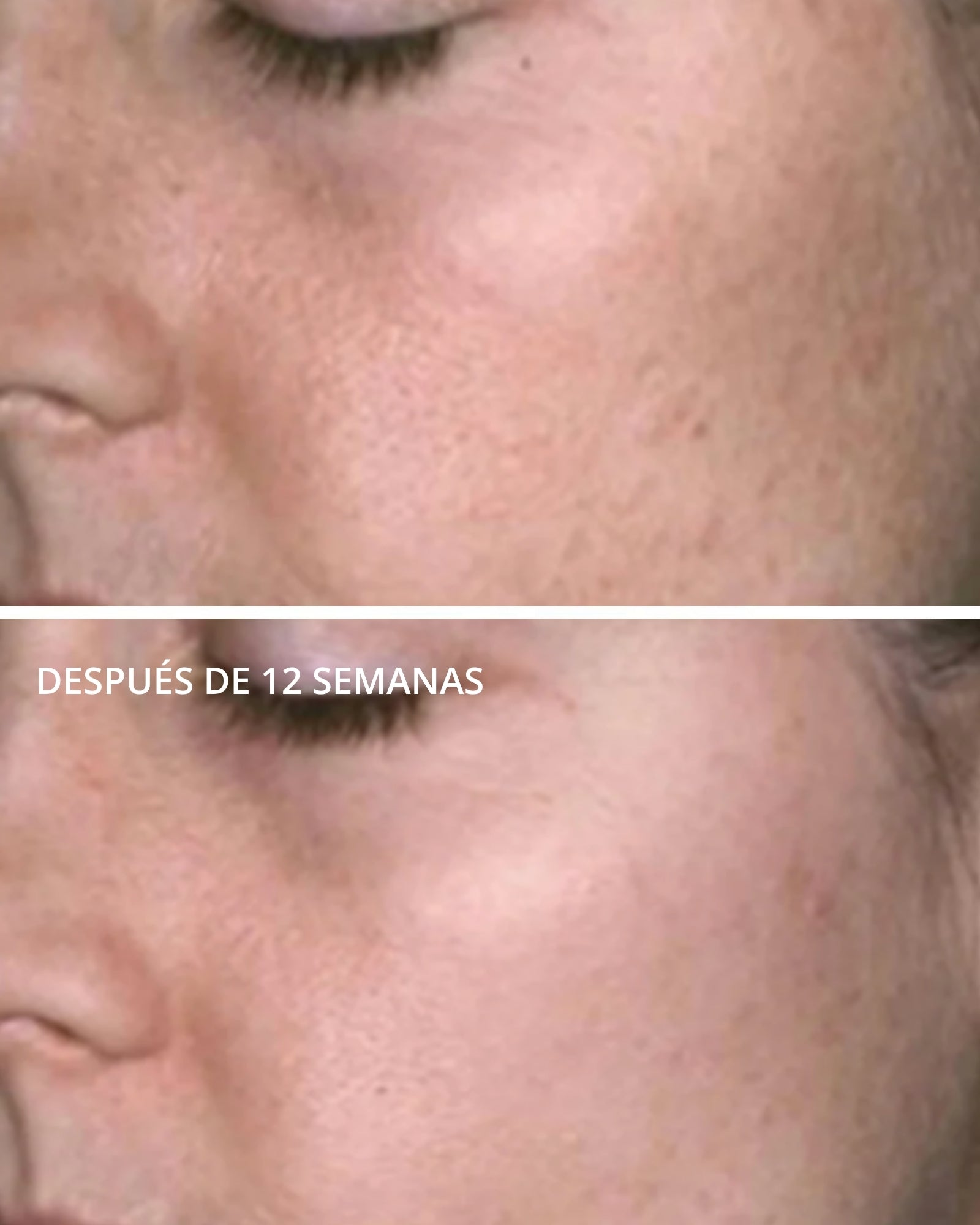 PHA Facial Cleanser Neostrata