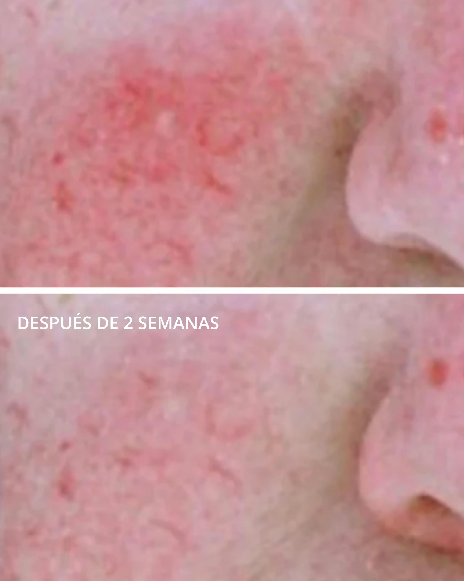 PHA Redness Neutralizing Serum Neostrata