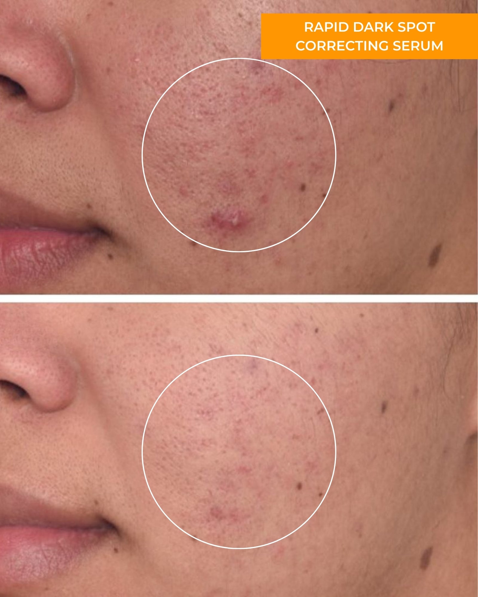Rapid Dark Spot Correcting Serum