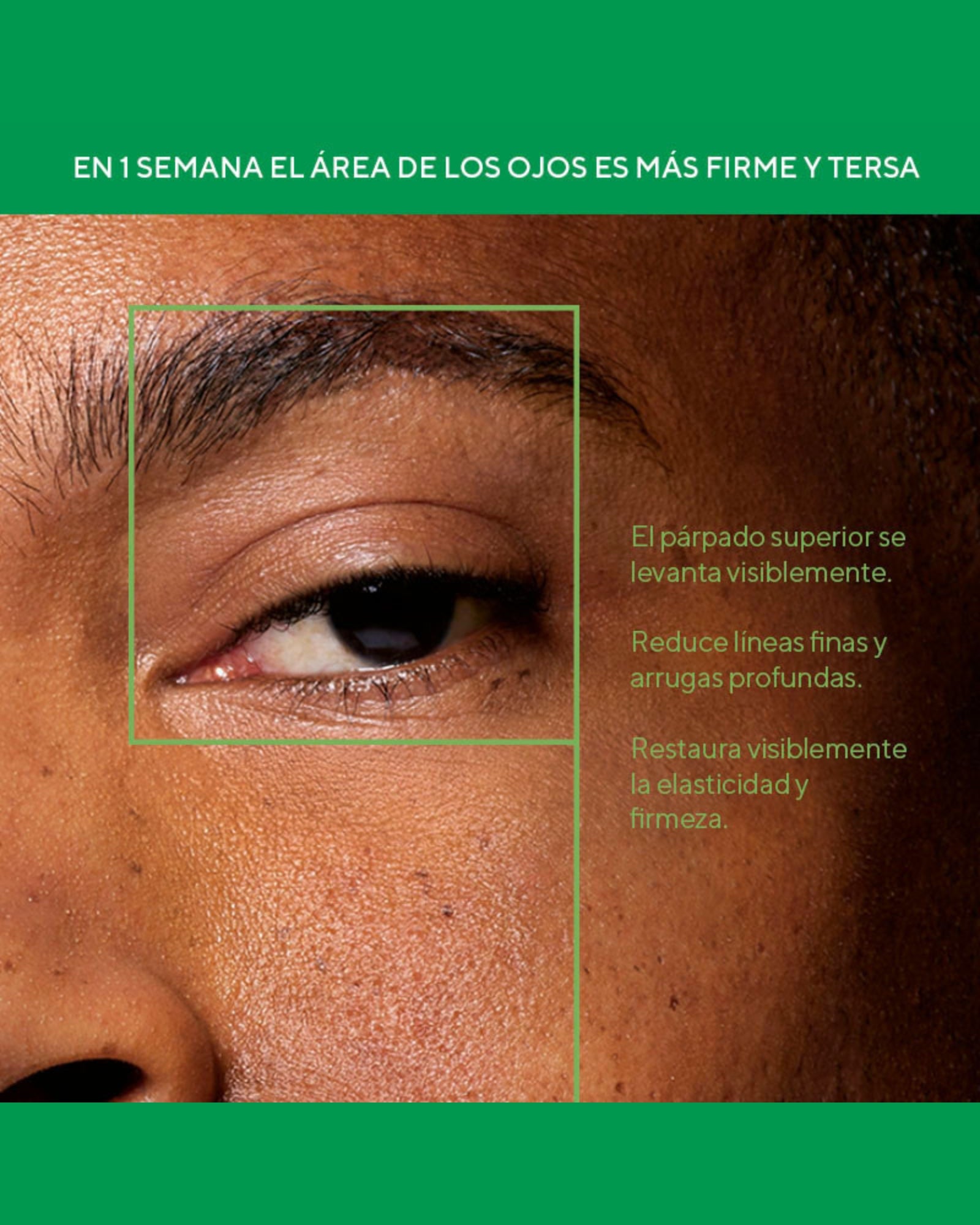 Retinal ReSculpt™ Eye Lift Treatment