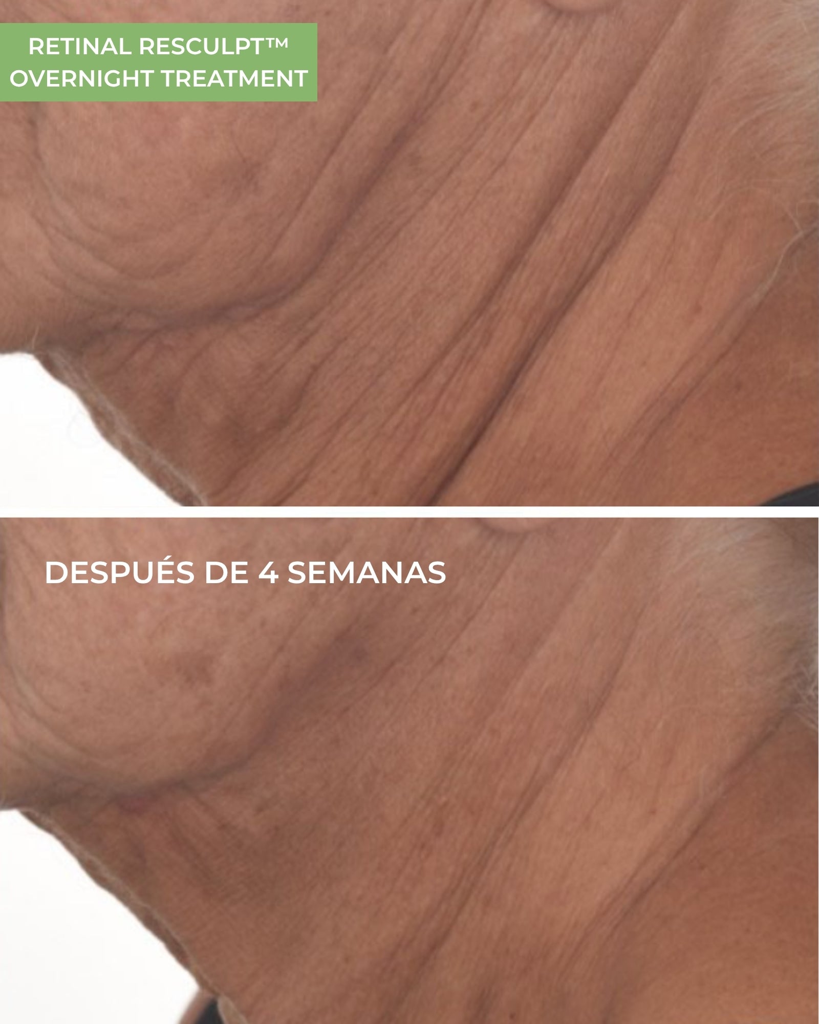 Retinal ReSculpt™ Overnight Treatment