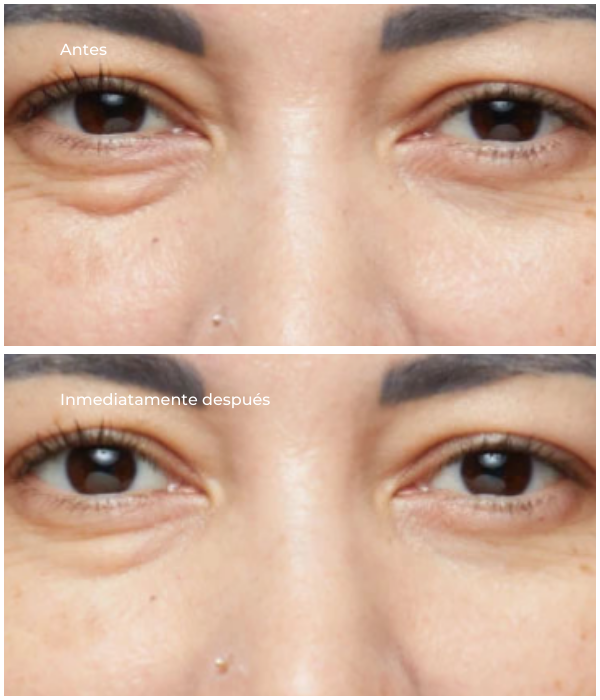 Pack Retinol Youth Renewal Eye Masks (5 Unidades)