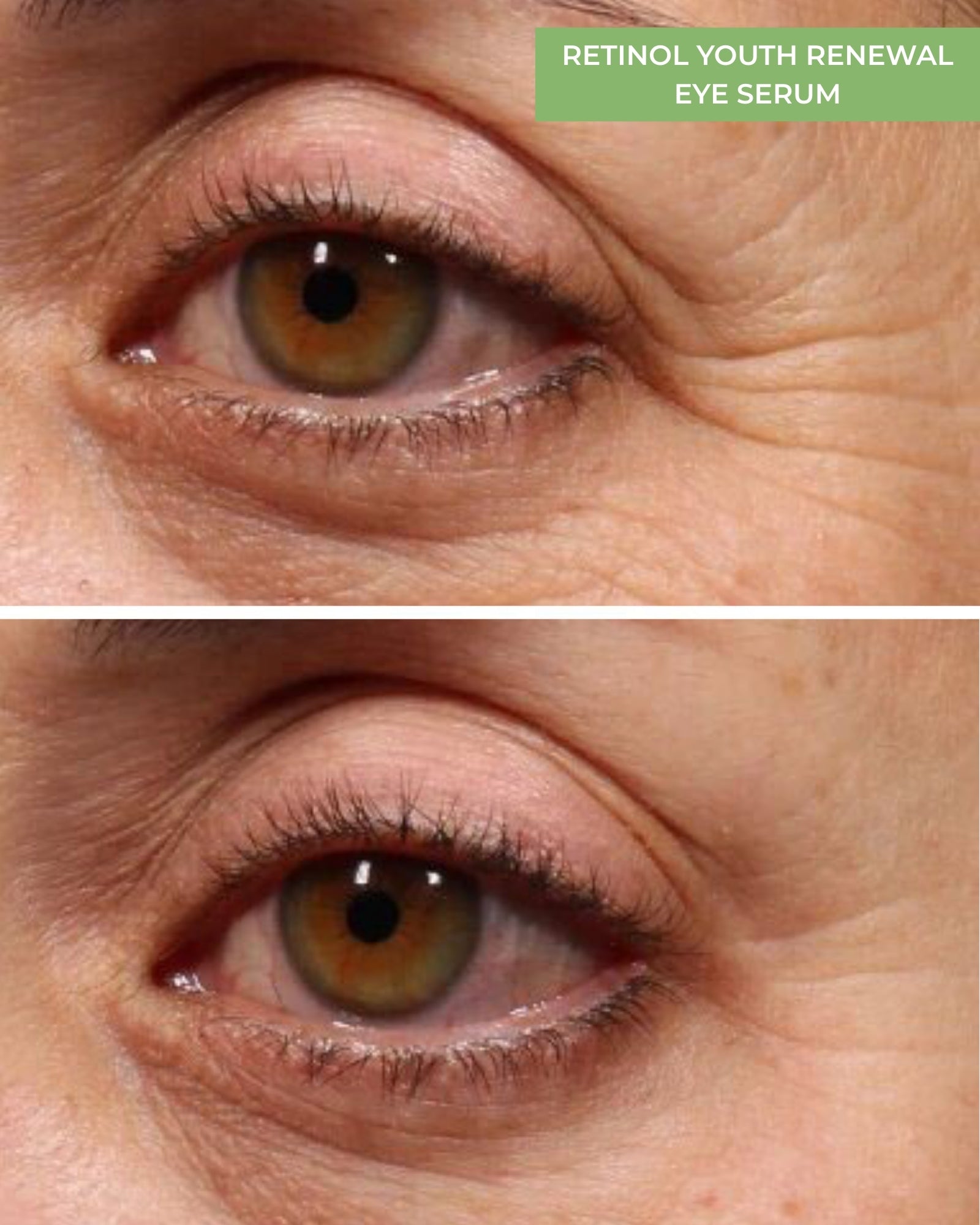 Retinol Youth Renewal Eye Serum