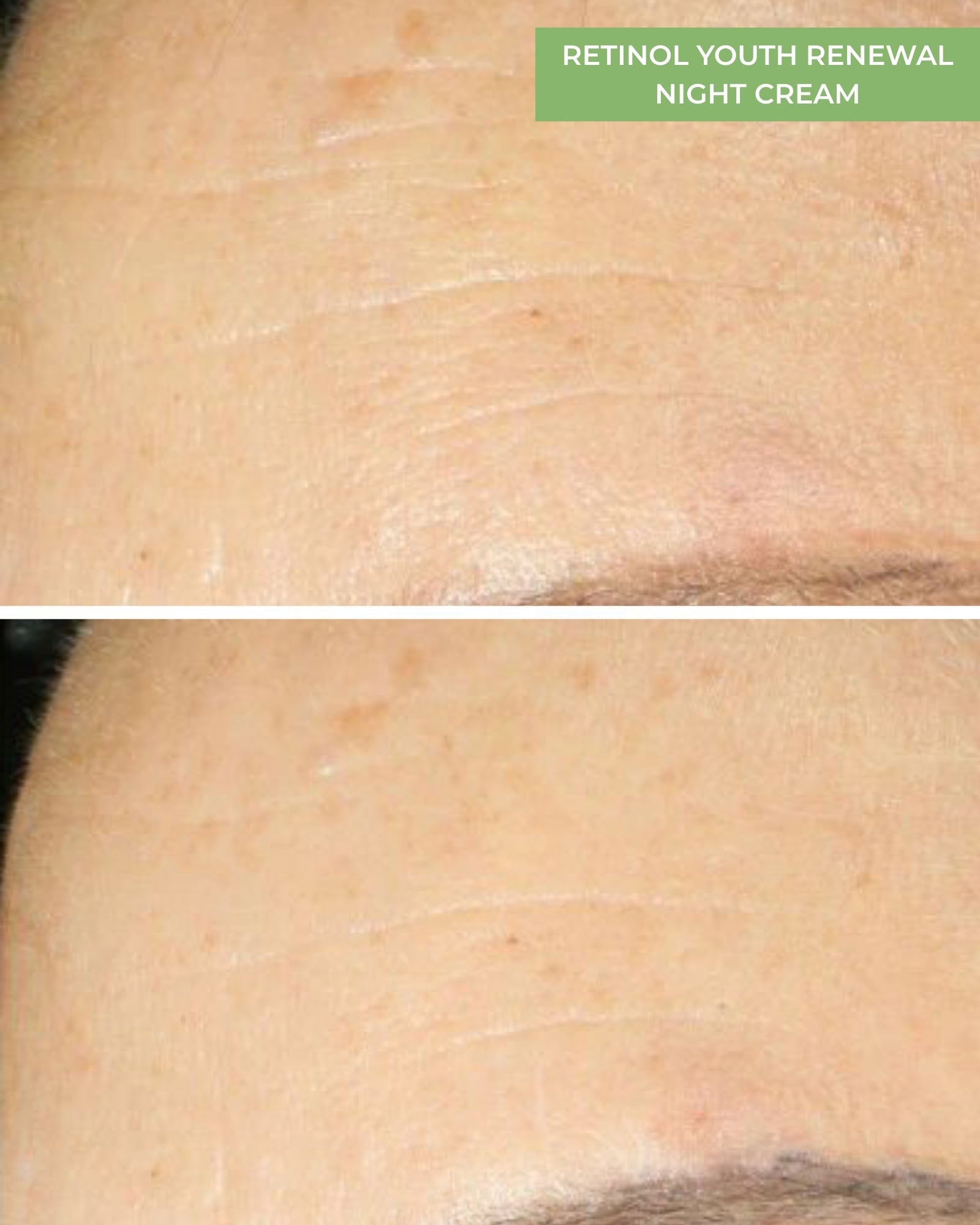 Retinol Youth Renewal Night Cream