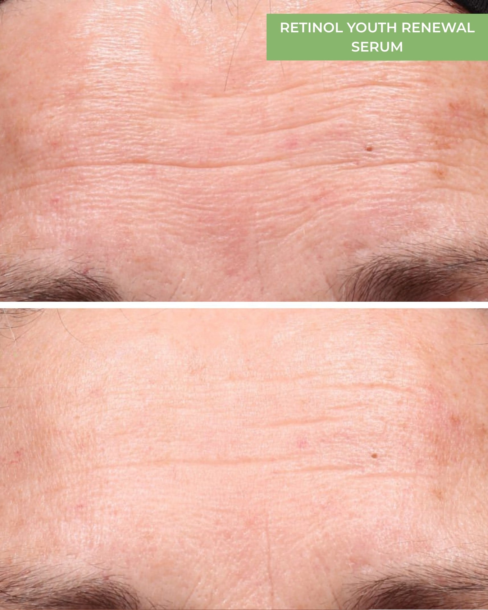 Retinol Youth Renewal Serum