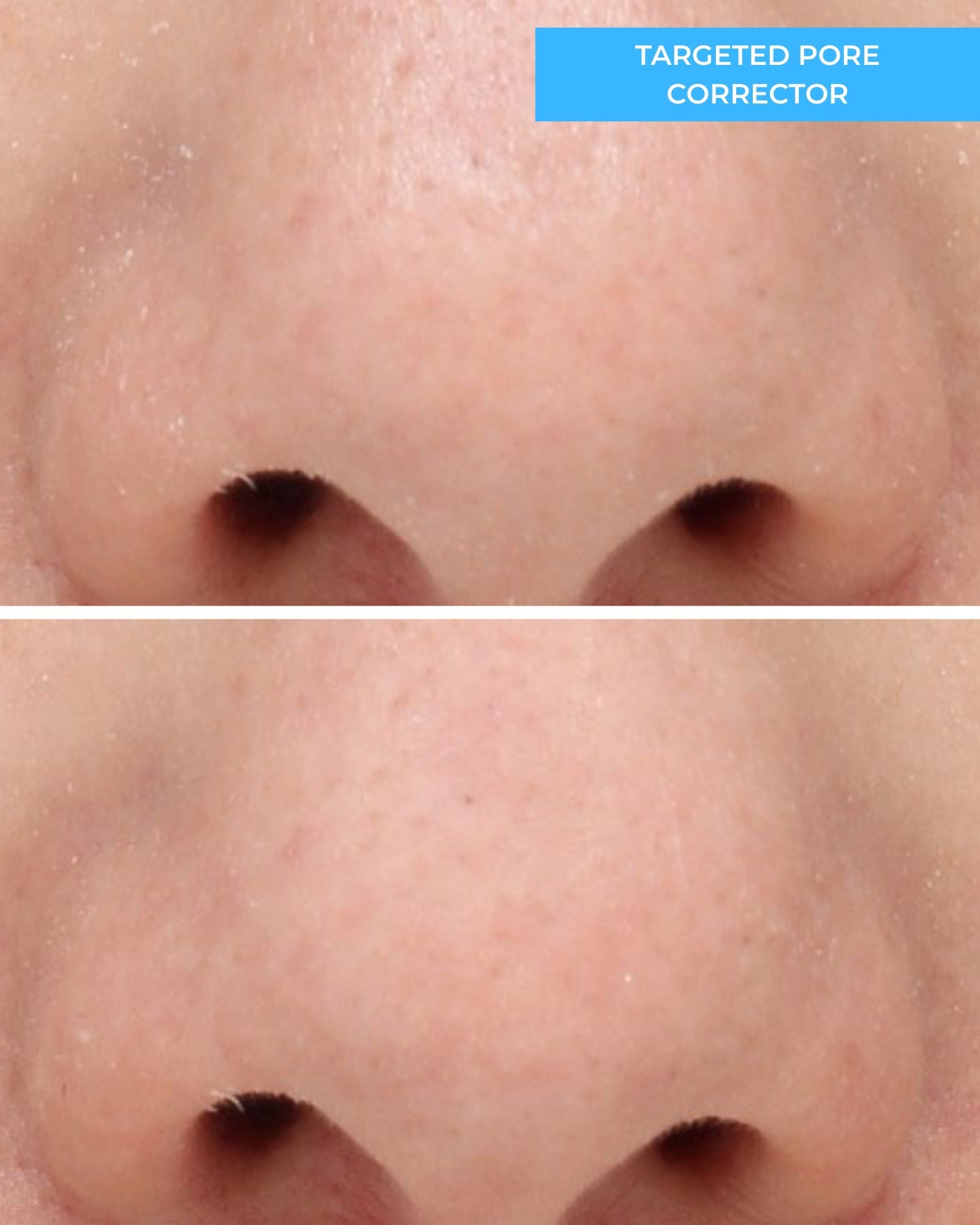 Targeted Pore Corrector