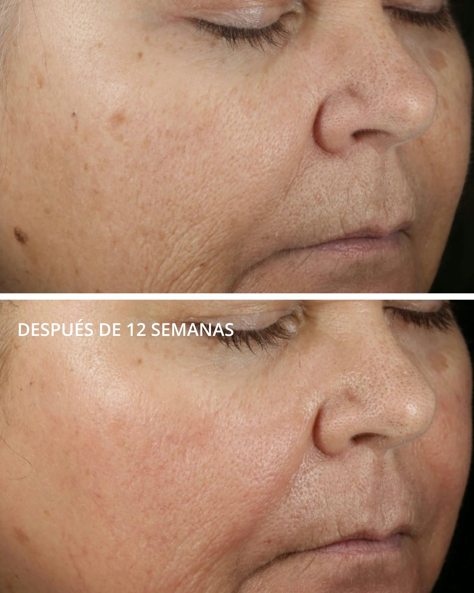 Vitamina C 15% + PHA Serum Neostrata