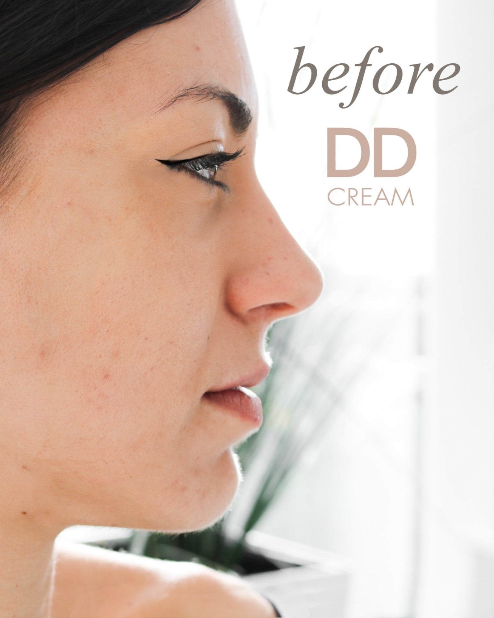 Antes de aplicar Casmara DD Cream: piel con imperfecciones y tono no unificado
