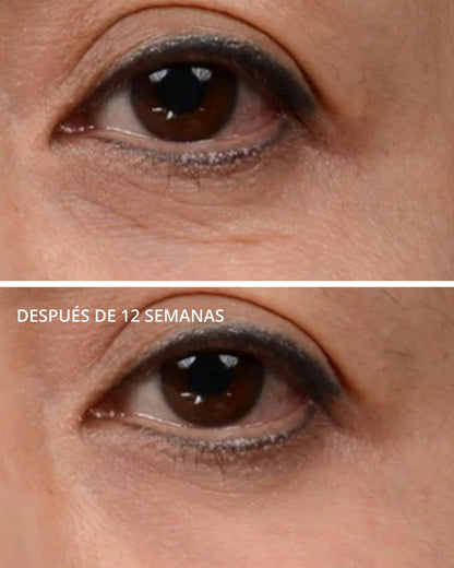 Brightening Eye Cream Neostrata