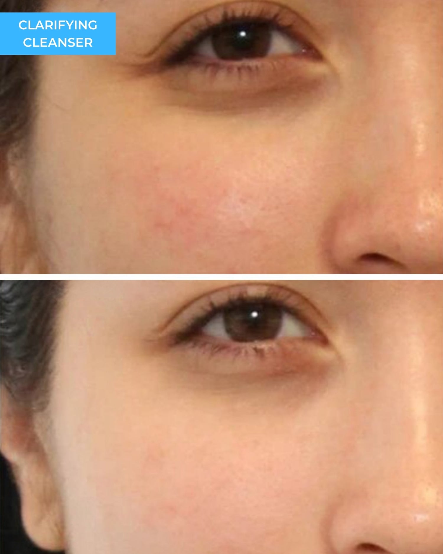 Clarifying Cleanser