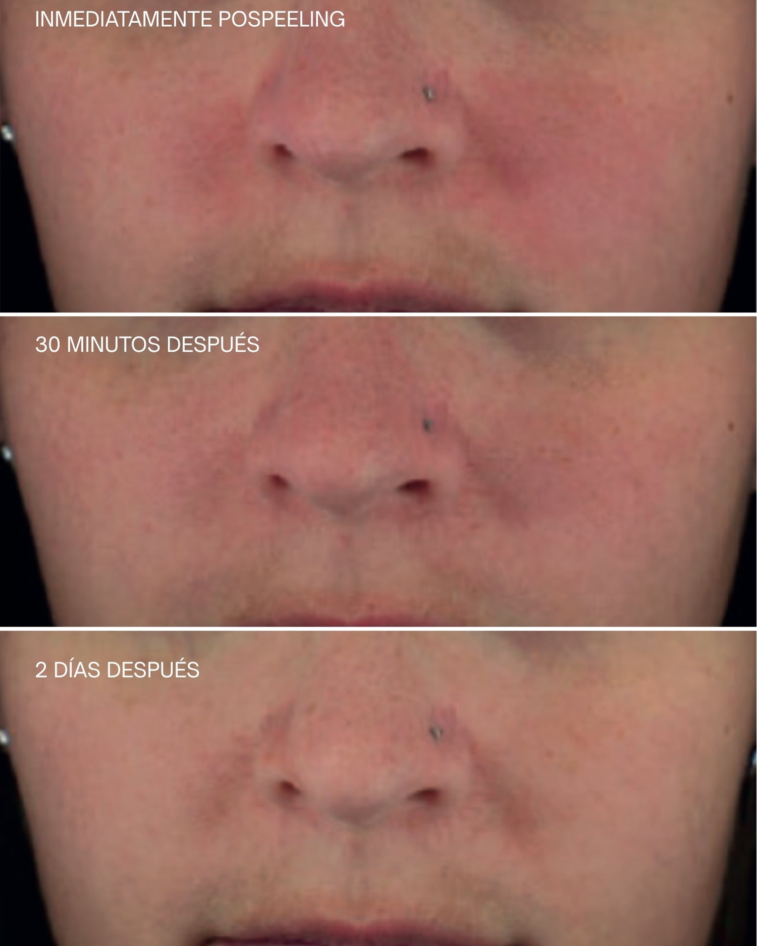Crema Facial Reafirmante Upgrade [AR]  Sensilis