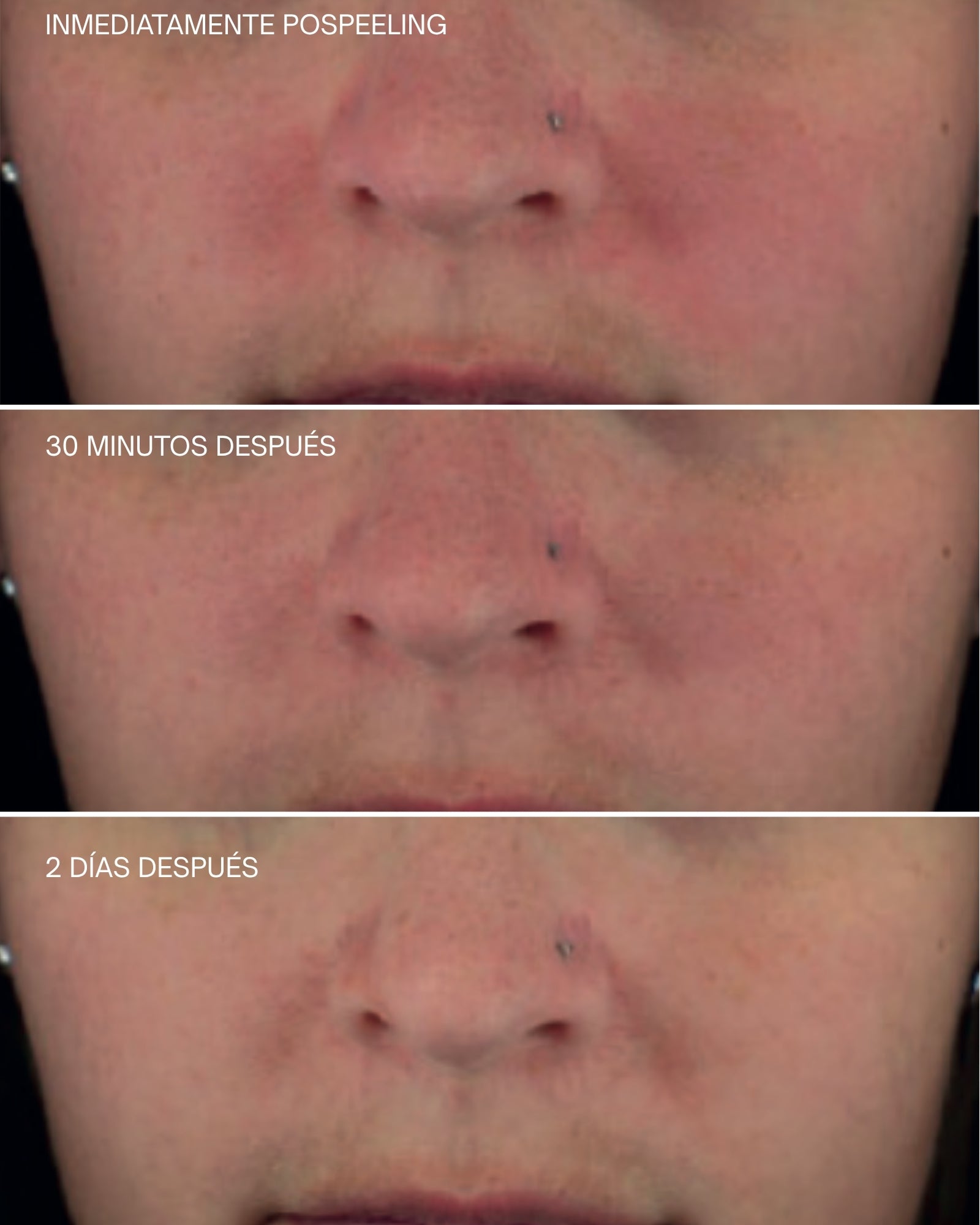 Crema Facial Reafirmante Upgrade [AR]  Sensilis
