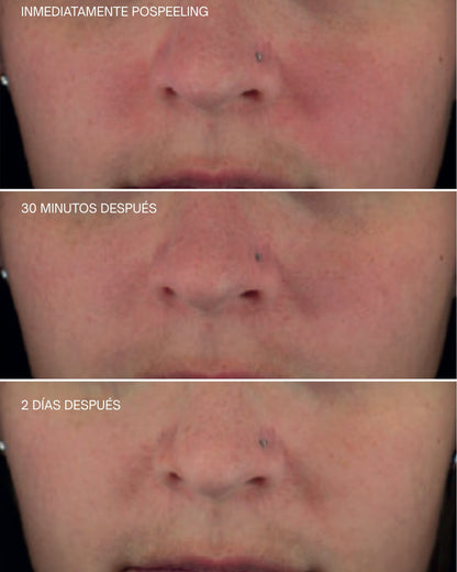Crema Facial Reafirmante Upgrade [AR]  Sensilis