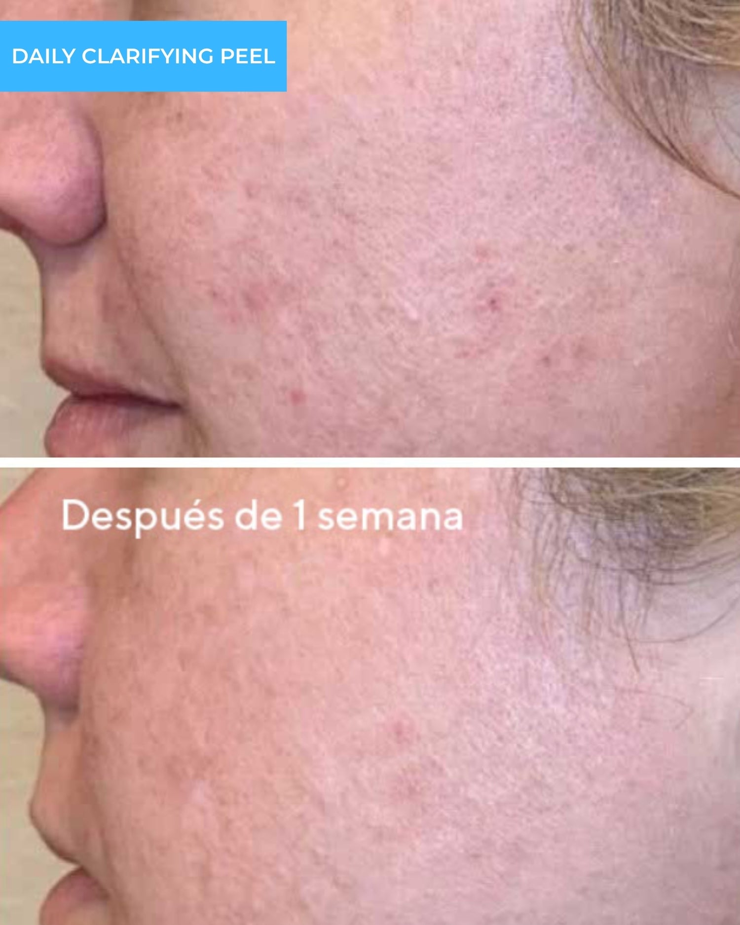 Daily Clarifying Peel