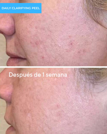 Daily Clarifying Peel