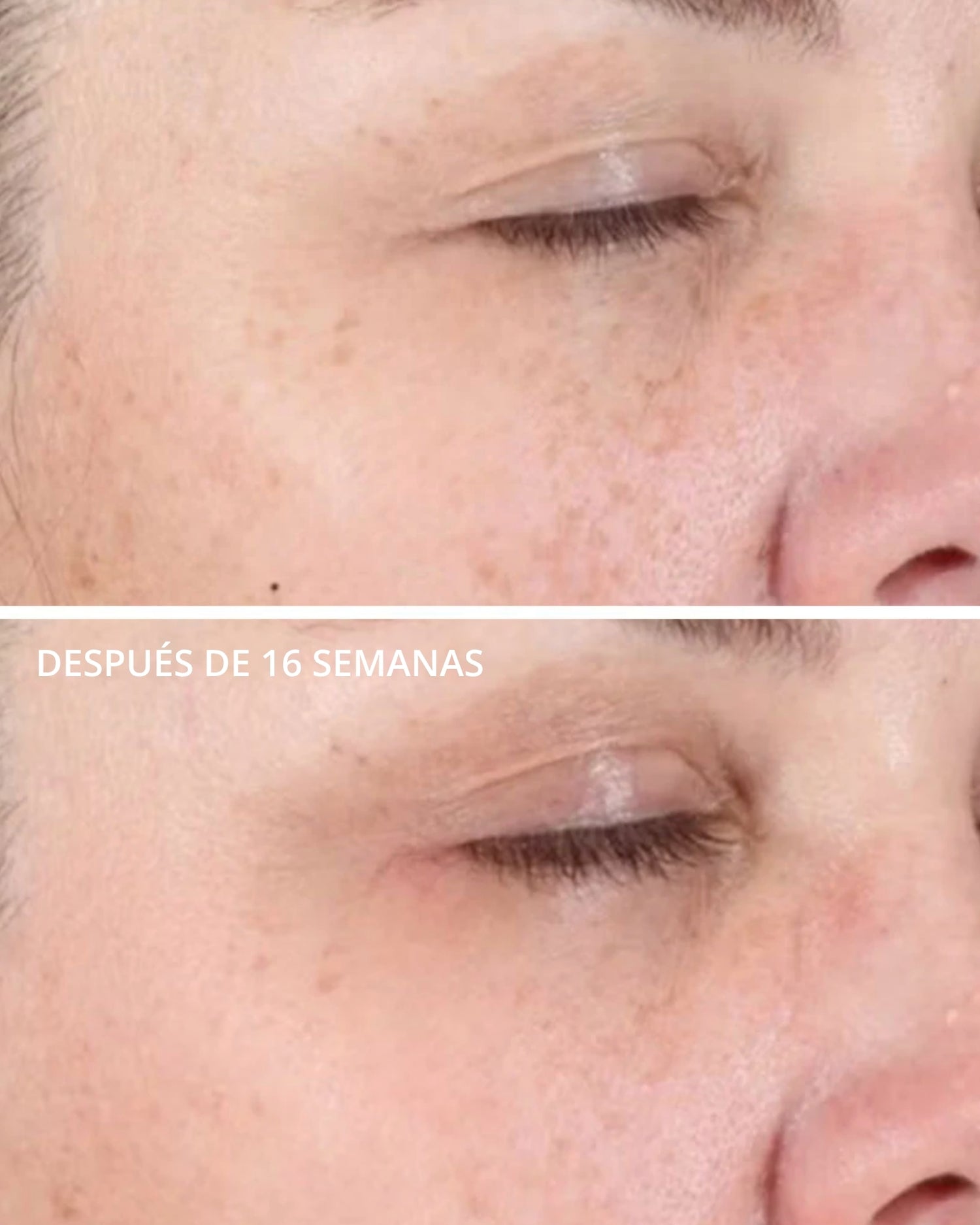 Illuminating Serum Neostrata