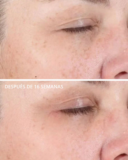 Illuminating Serum Neostrata