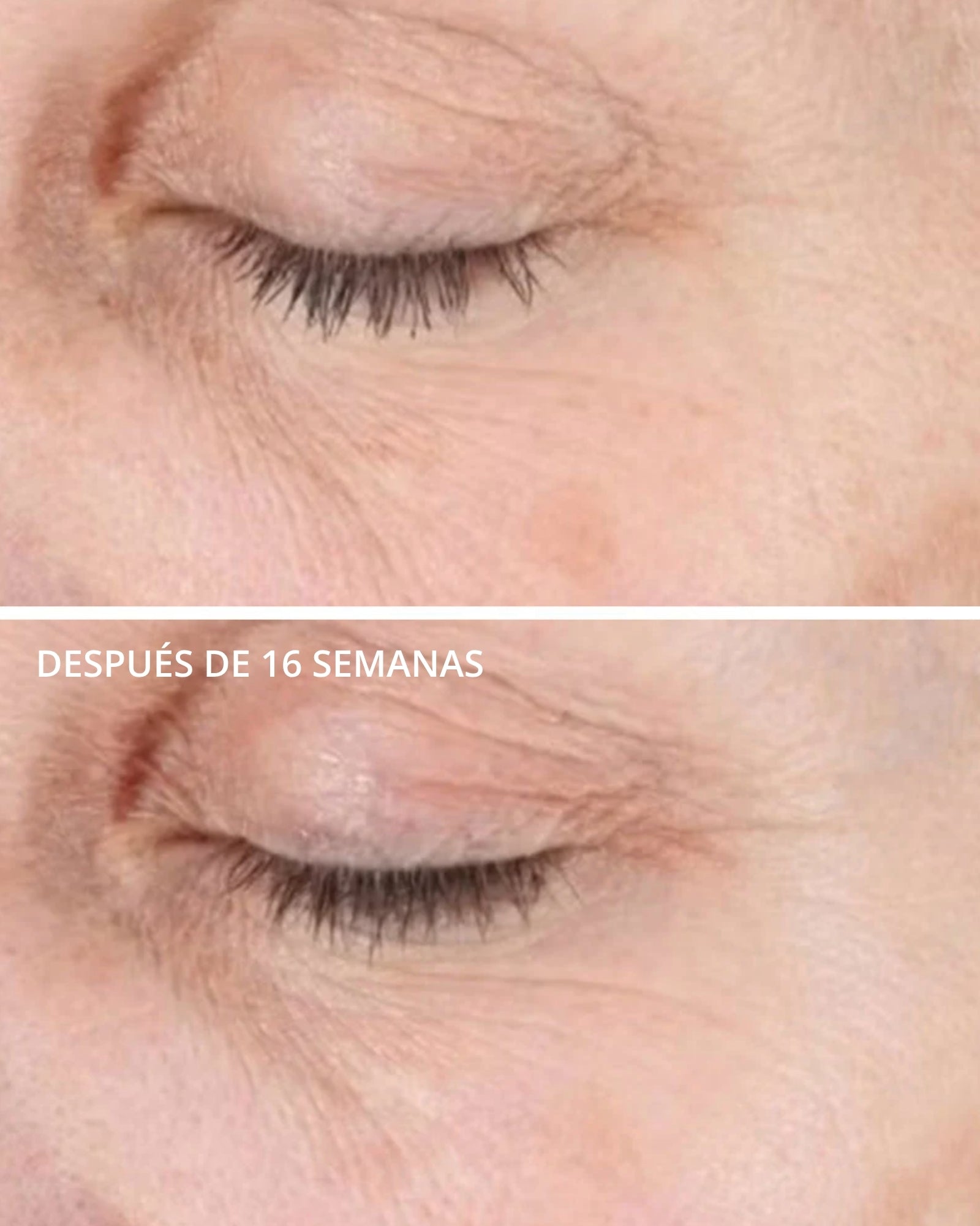 Illuminating Serum Neostrata