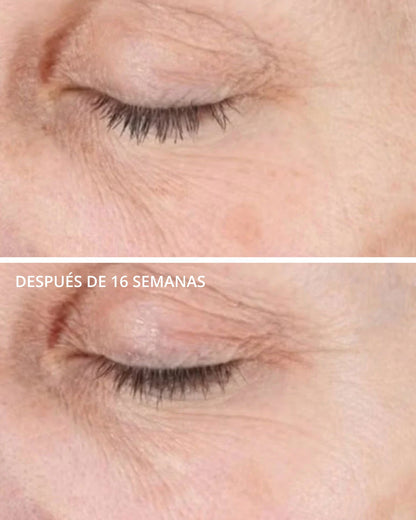 Illuminating Serum Neostrata