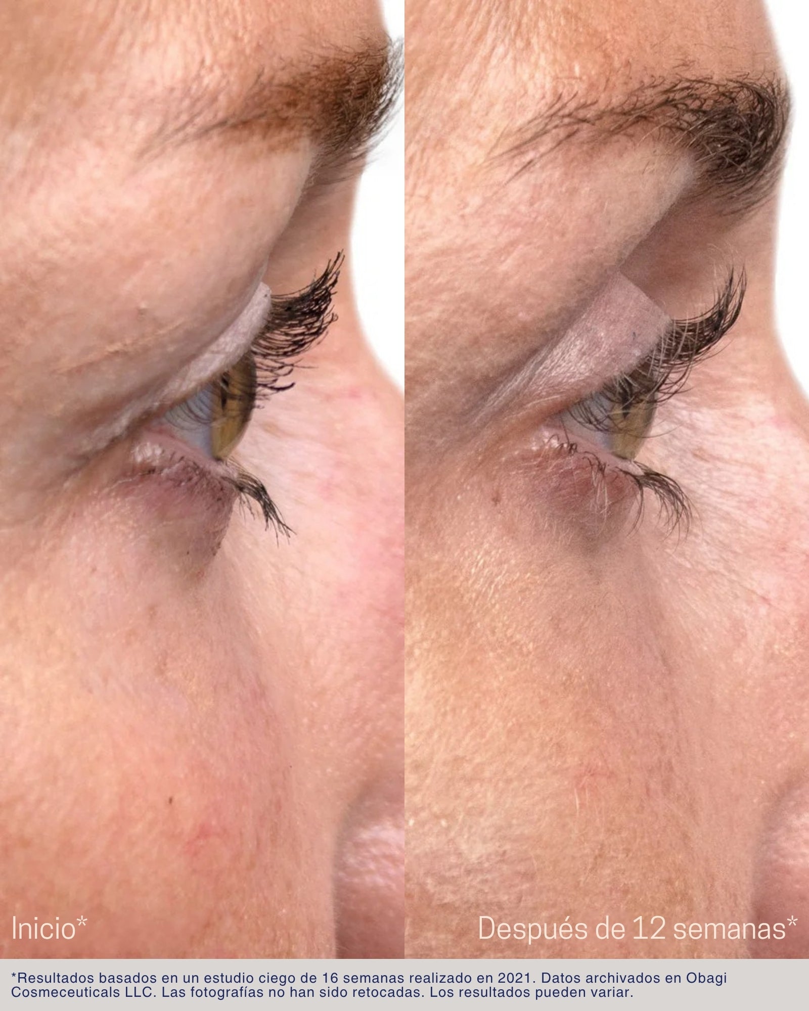 Nu-Cil® Eyelash Enhancing Serum Obagi
