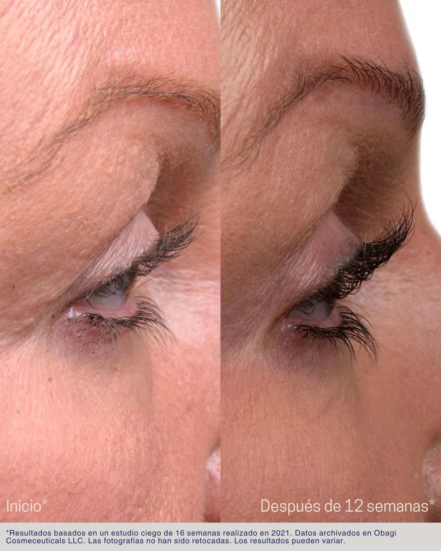 Nu-Cil® Eyelash Enhancing Serum Obagi