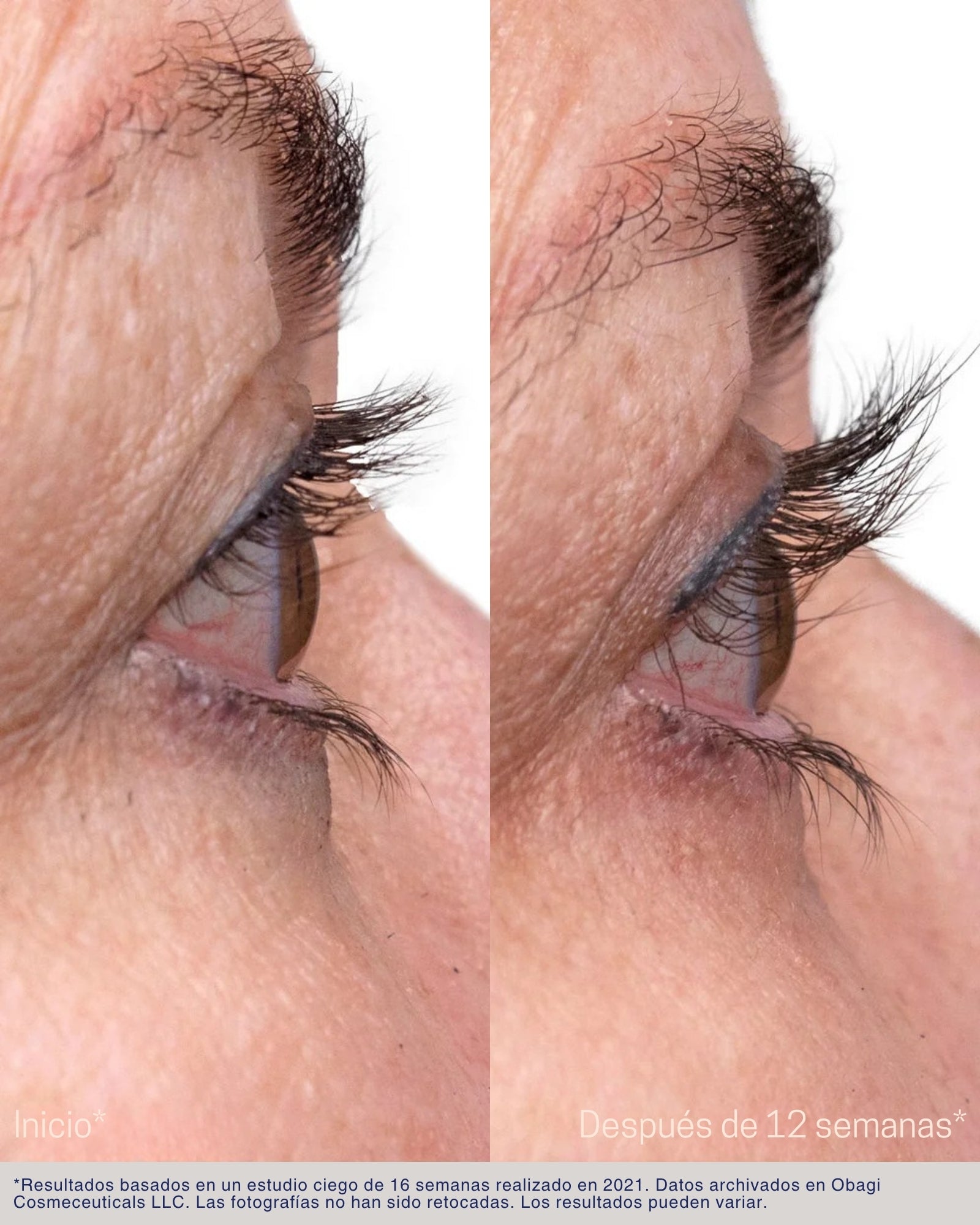 Nu-Cil® Eyelash Enhancing Serum Obagi