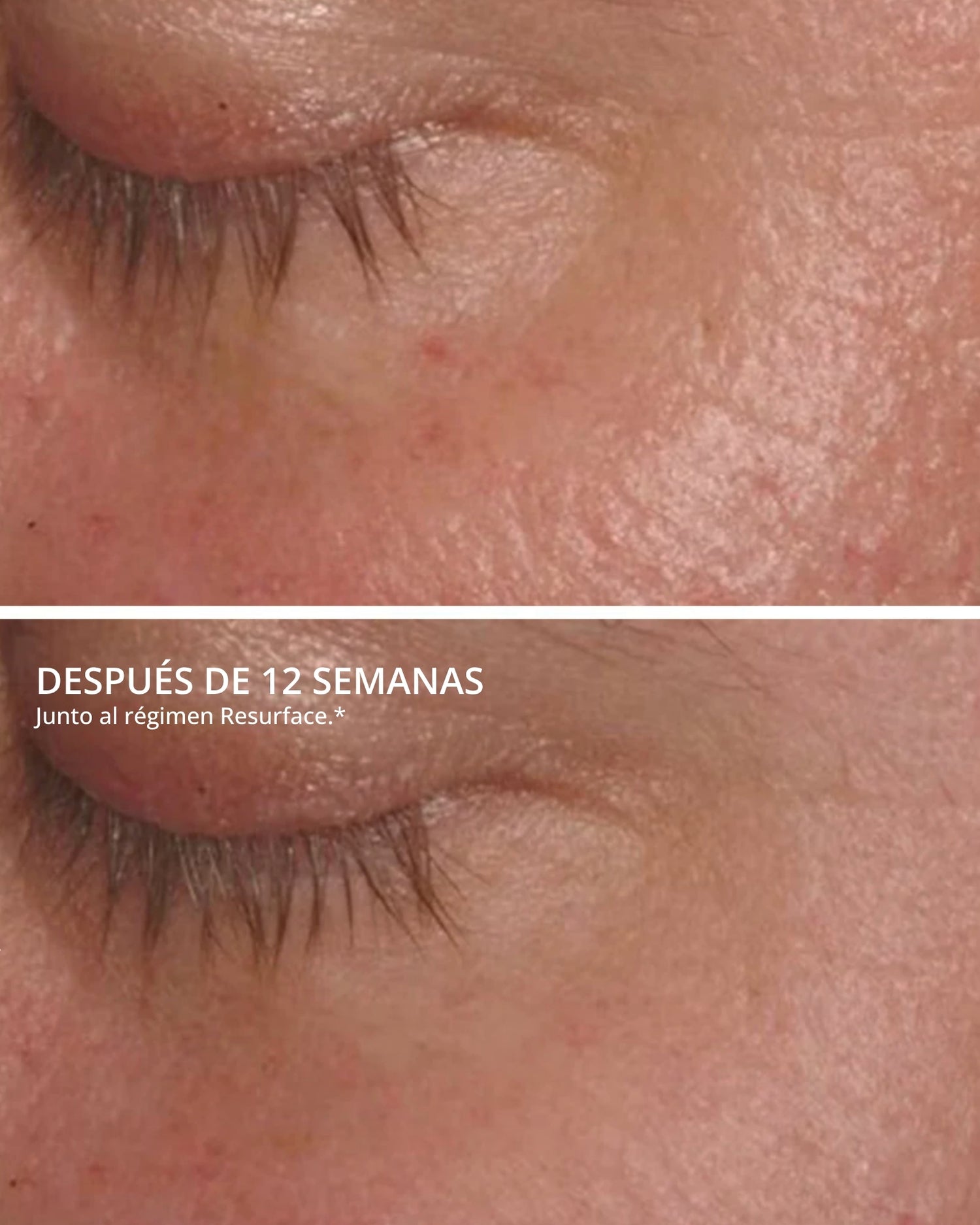 Foaming Glycolic Wash Neostrata