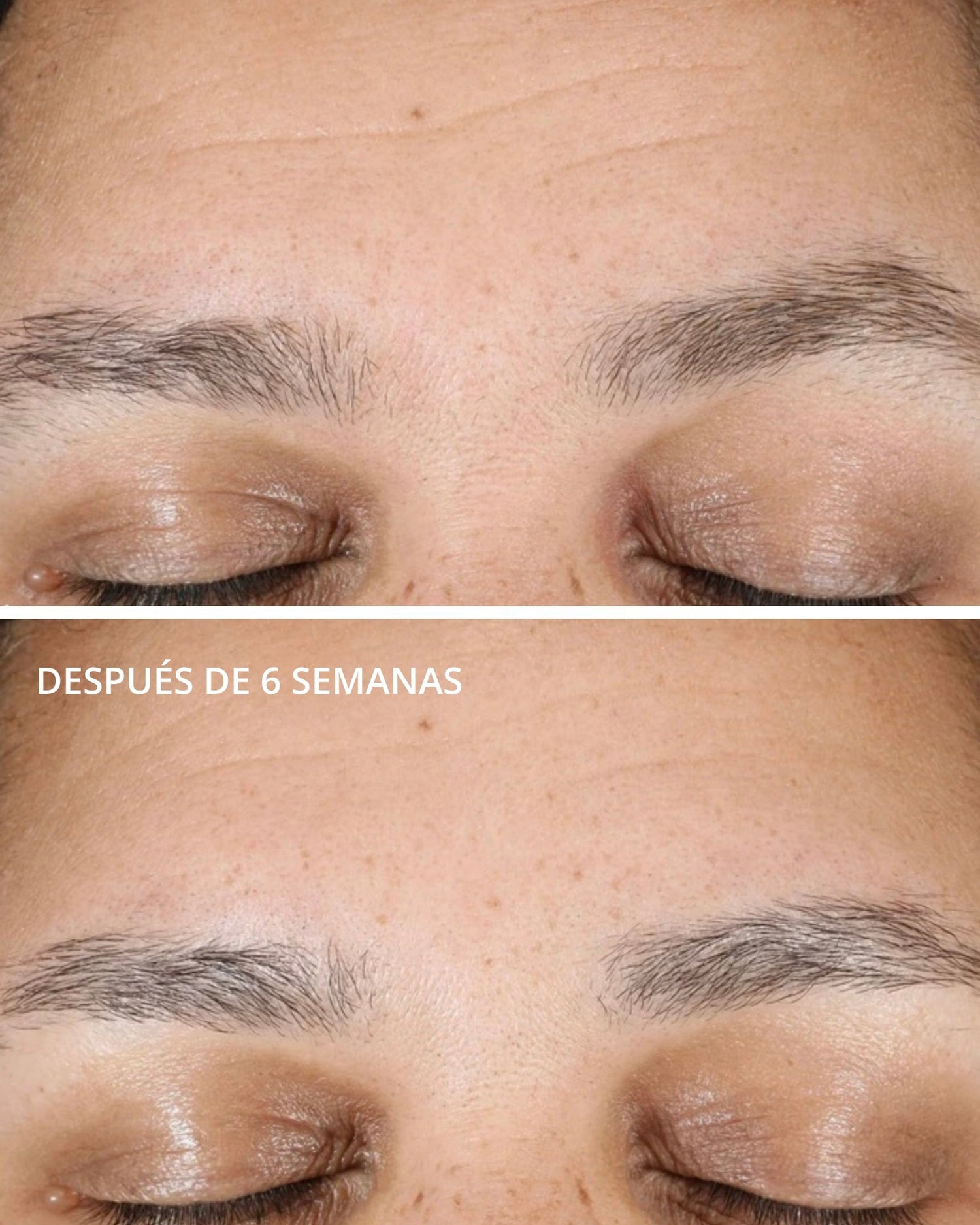 Hyaluronic Luminous Lift Neostrata