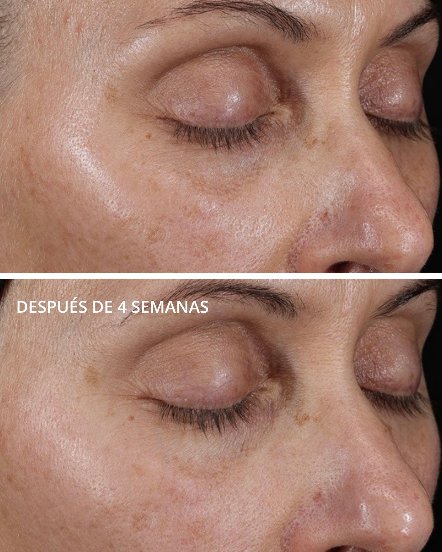 Intensive Eye Therapy con MicroDiPéptido229® Neostrata