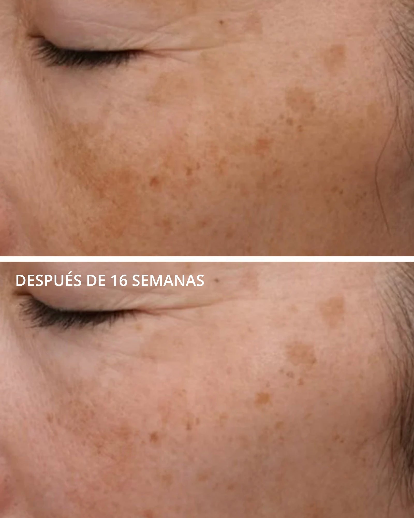 Matrix Support SPF 30 Neostrata