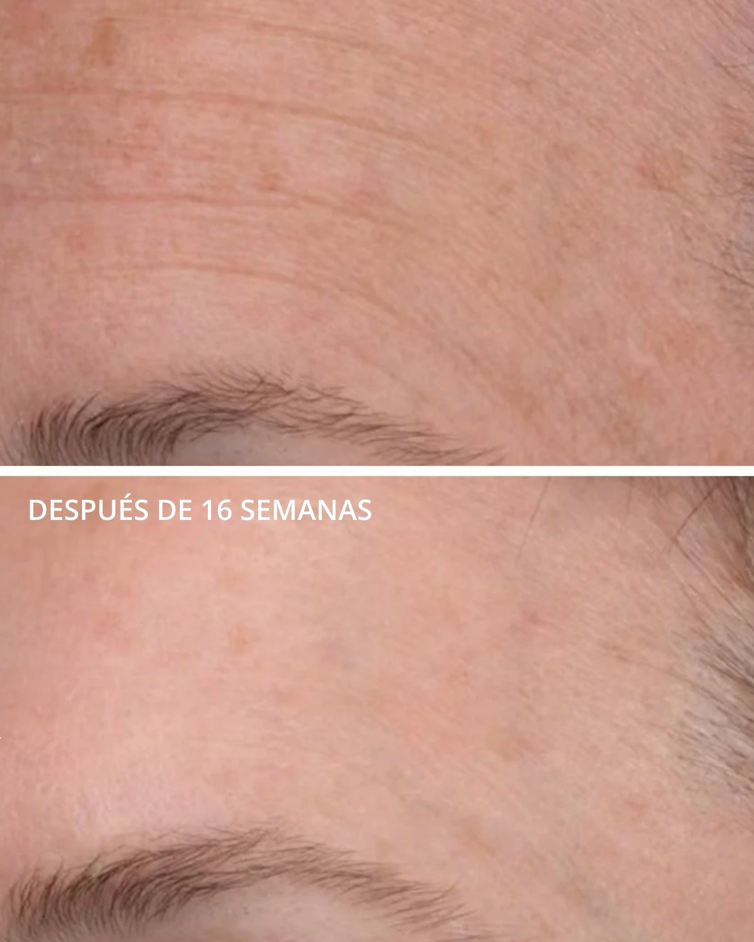 Matrix Support SPF 30 Neostrata
