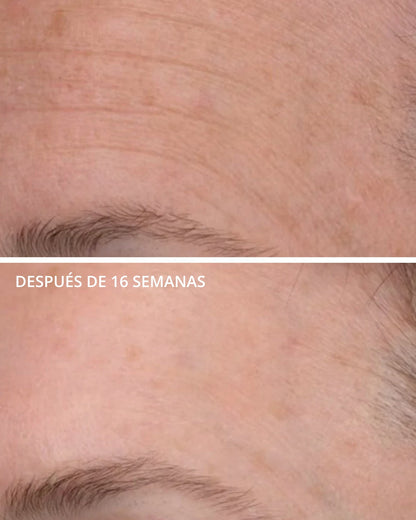 Matrix Support SPF 30 Neostrata
