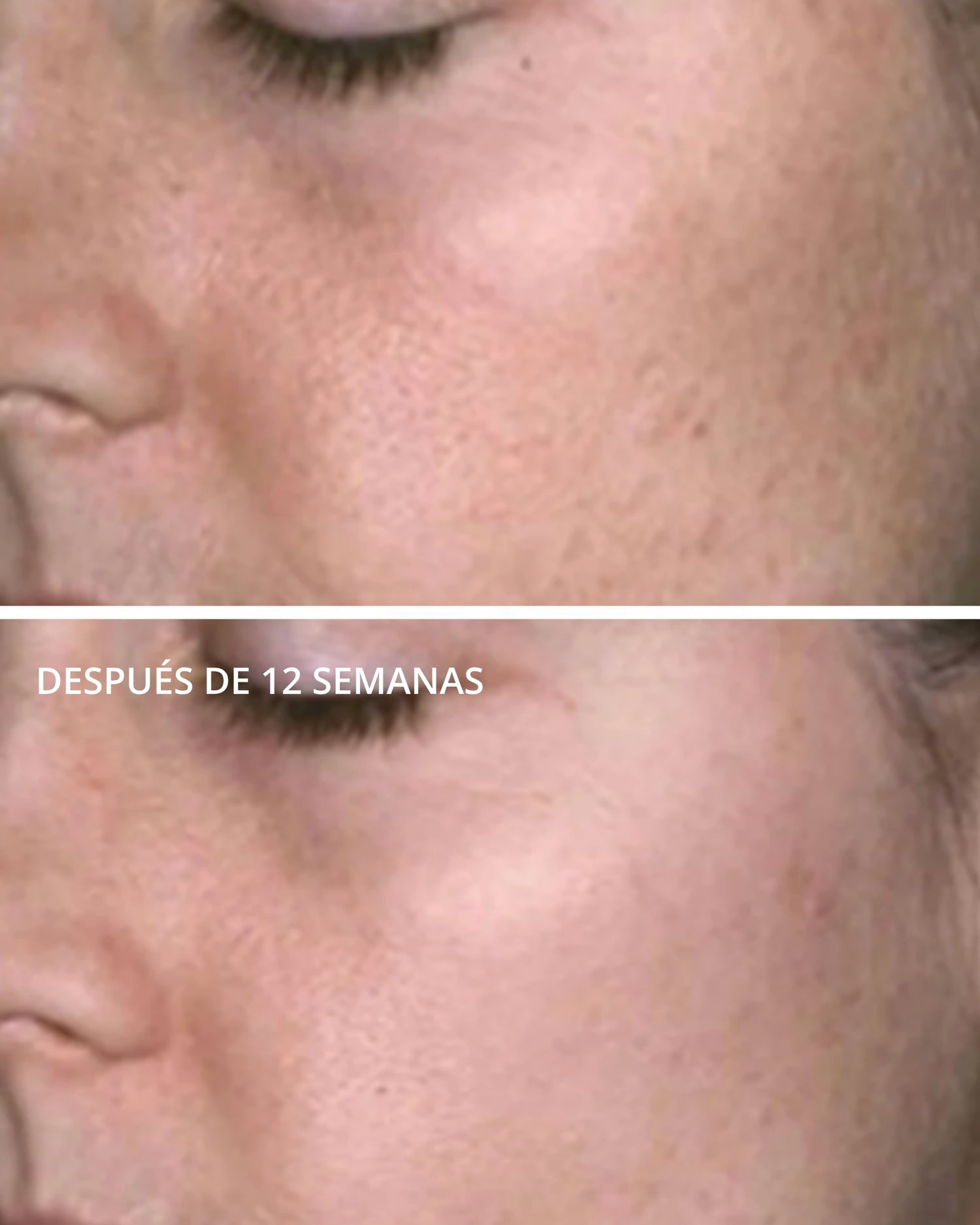 PHA Facial Cleanser Neostrata