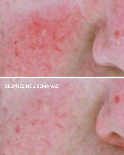 PHA Redness Neutralizing Serum Neostrata