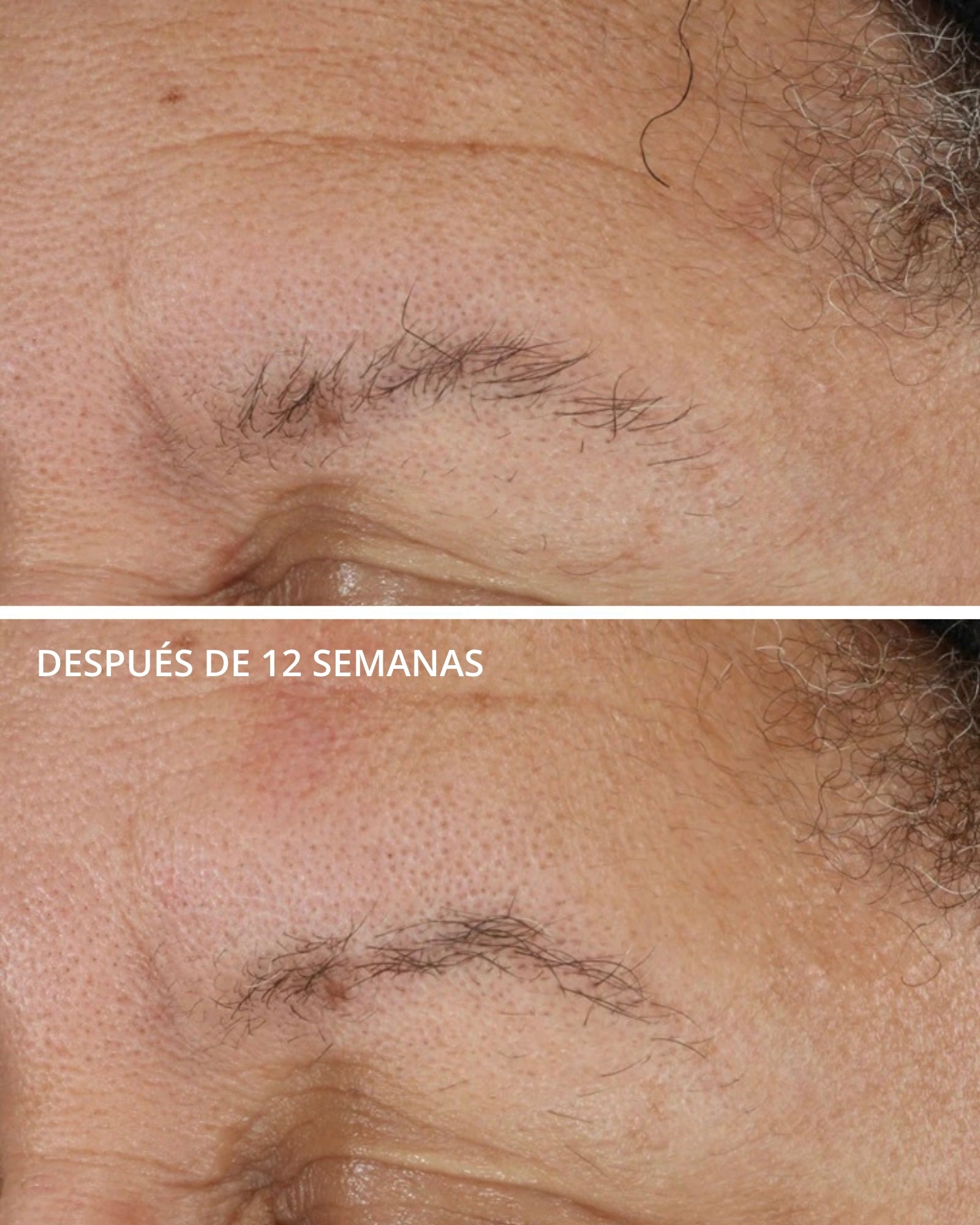 Potent Retinol Complex Neostrata