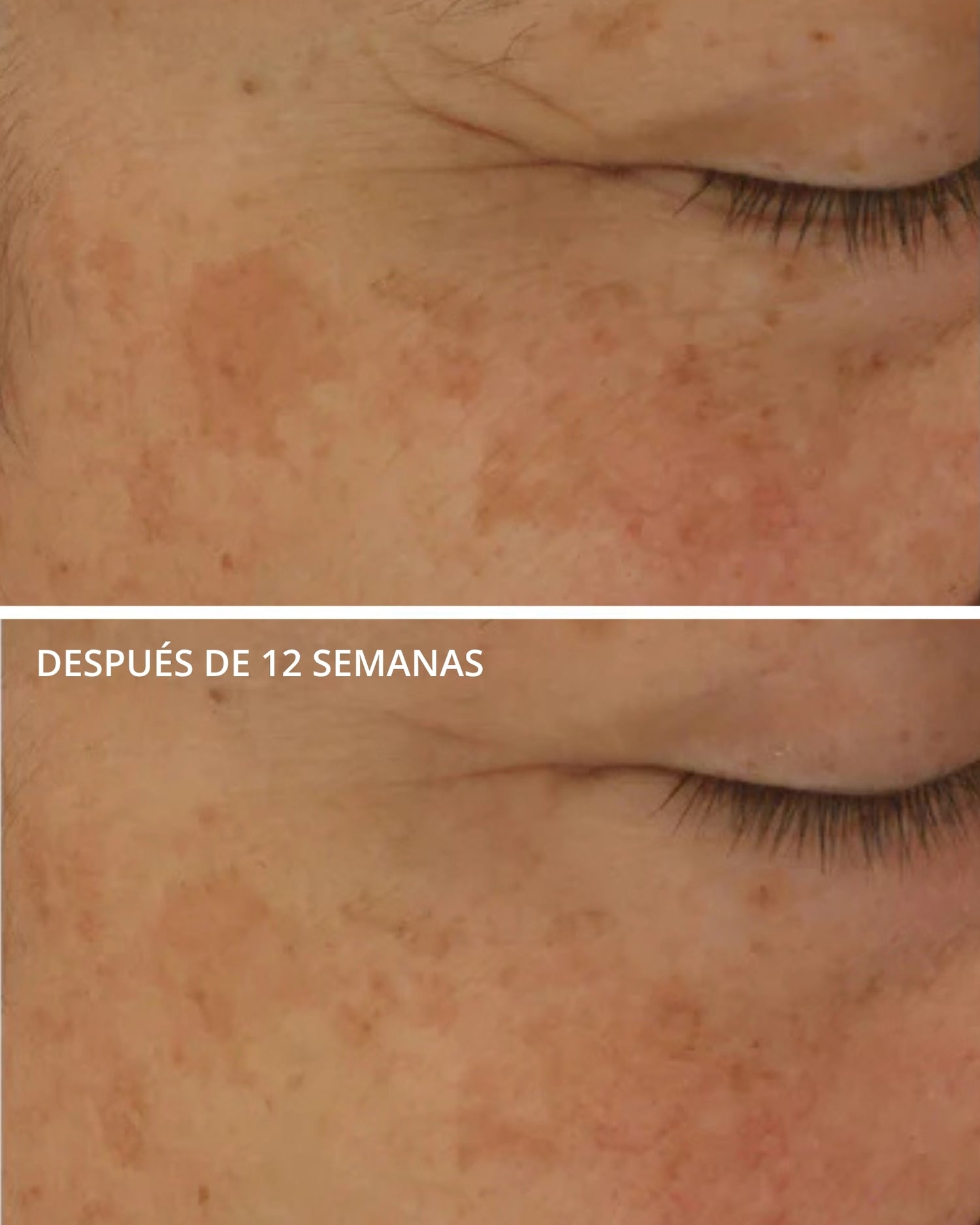 Potent Retinol Complex Neostrata