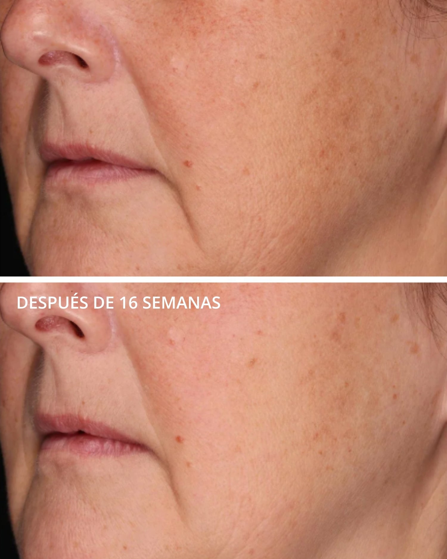 Rebound Sculpting Cream con MicroDiPéptido229® Neostrata
