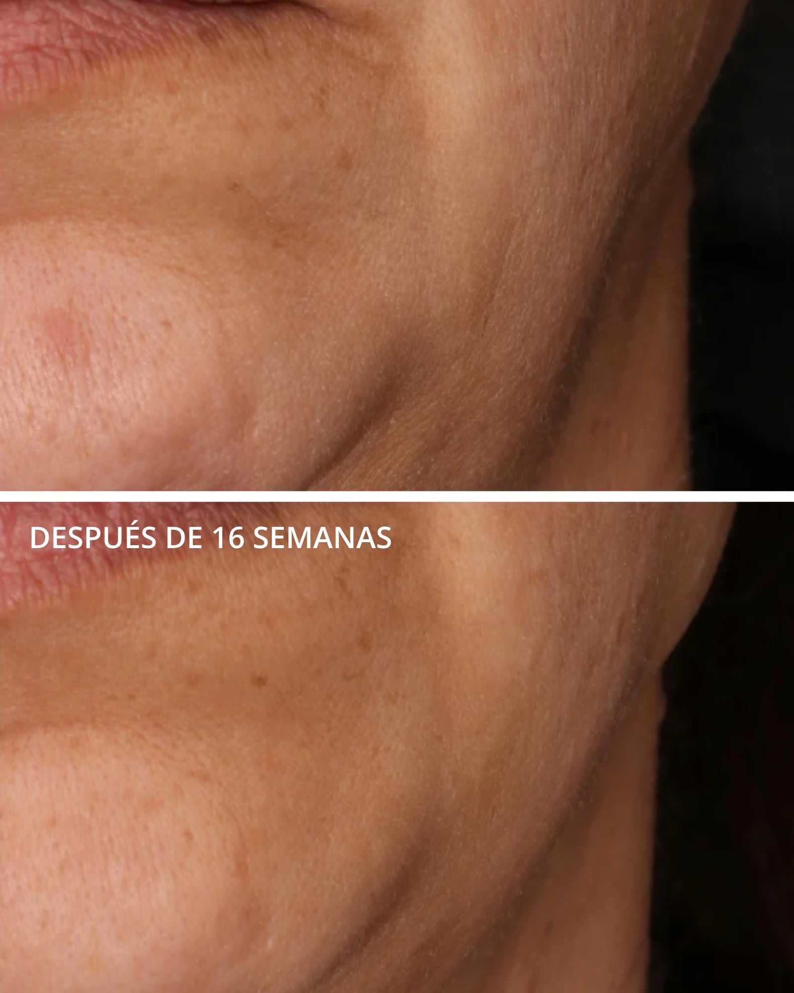 Rebound Sculpting Cream con MicroDiPéptido229® Neostrata