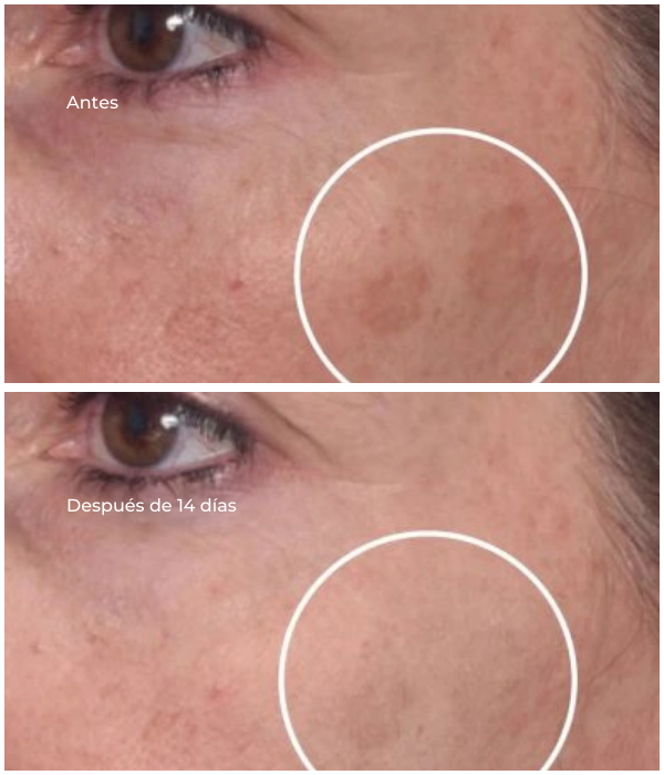 Rapid Dark Spot Correcting Serum