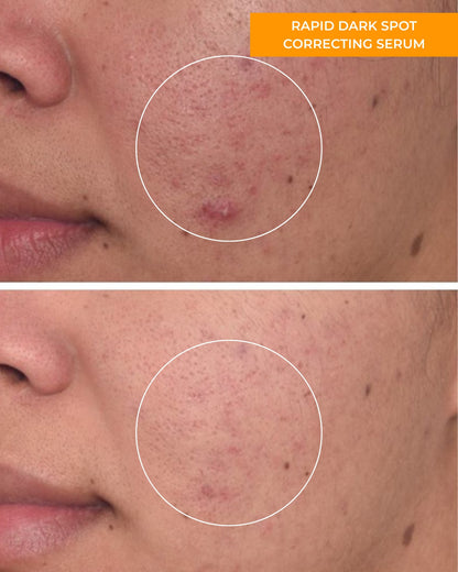 Rapid Dark Spot Correcting Serum