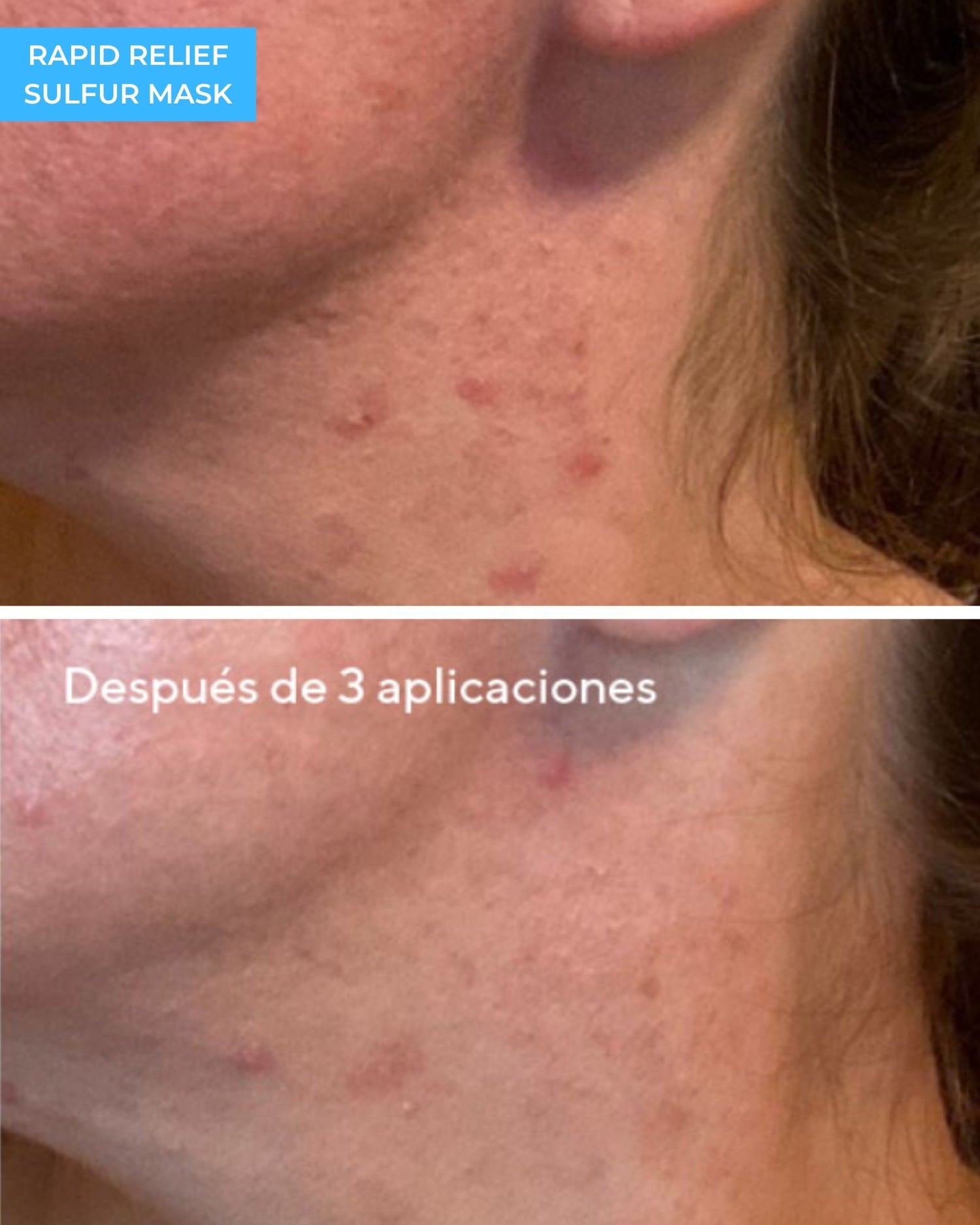 Rapid Relief Sulfur Mask