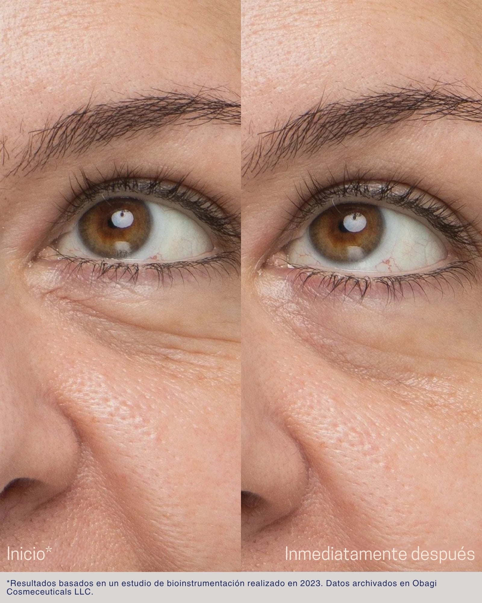 Daily Hydro-Drops® Rejuvenating Eye Gel Cream Obagi