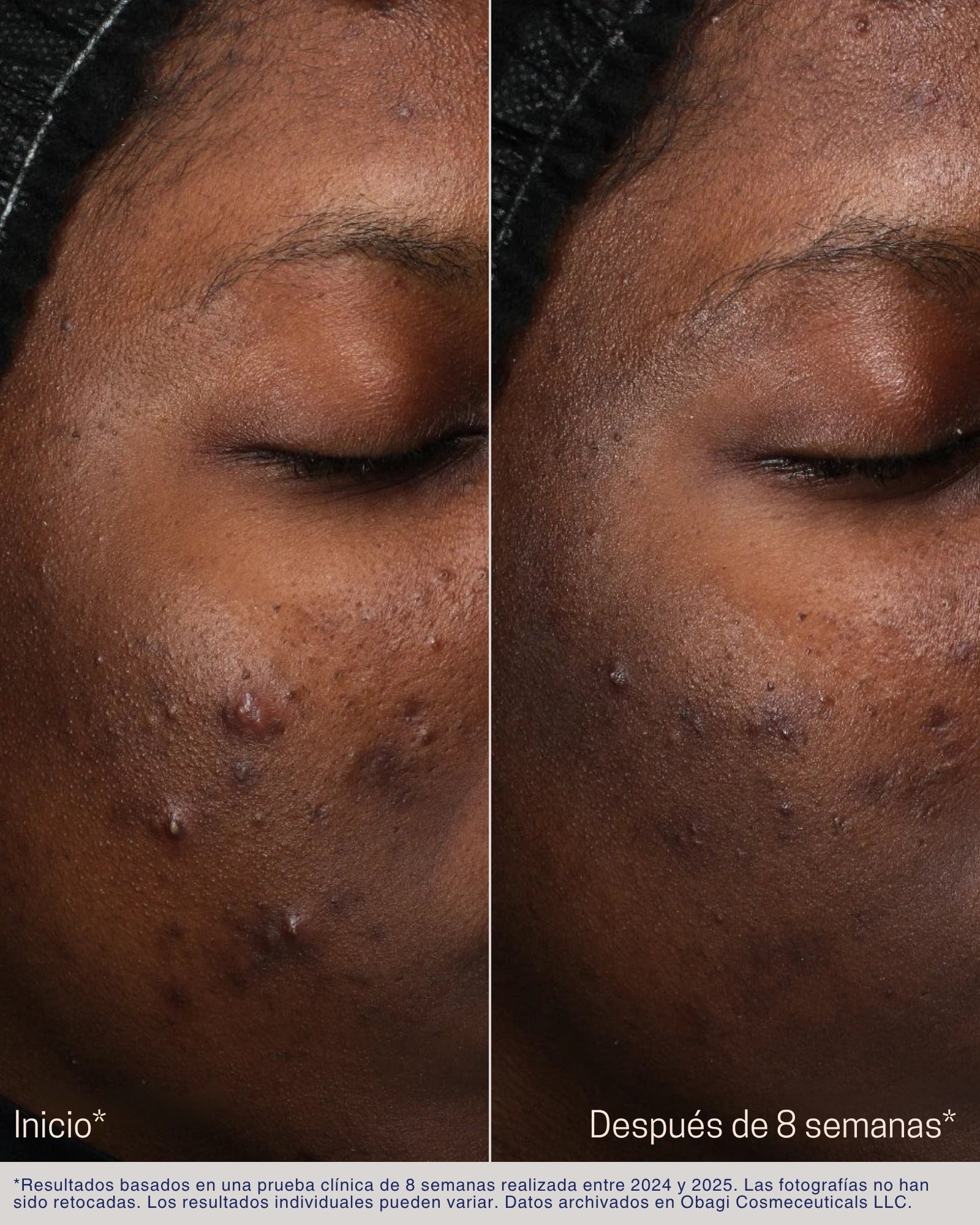Retinol + PHA Refining Night Cream Obagi