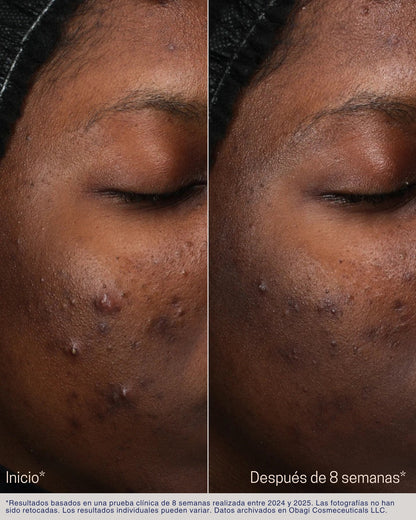 Retinol + PHA Refining Night Cream Obagi